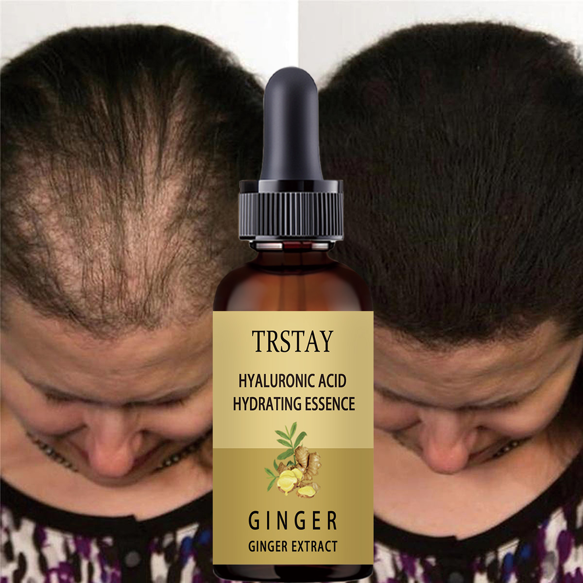 Siero per la crescita dei cape - Hair Care Gisou recensione e prezzo