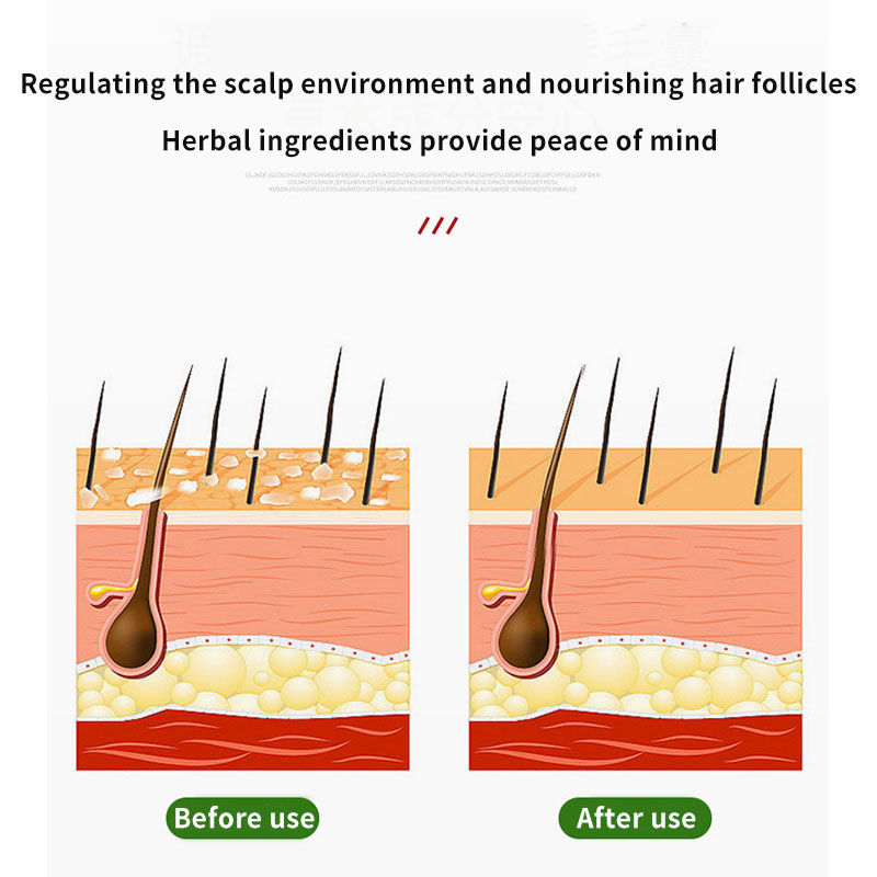 Sophora Flavescens Crema per f - Hair Care Oil recensione e prezzo
