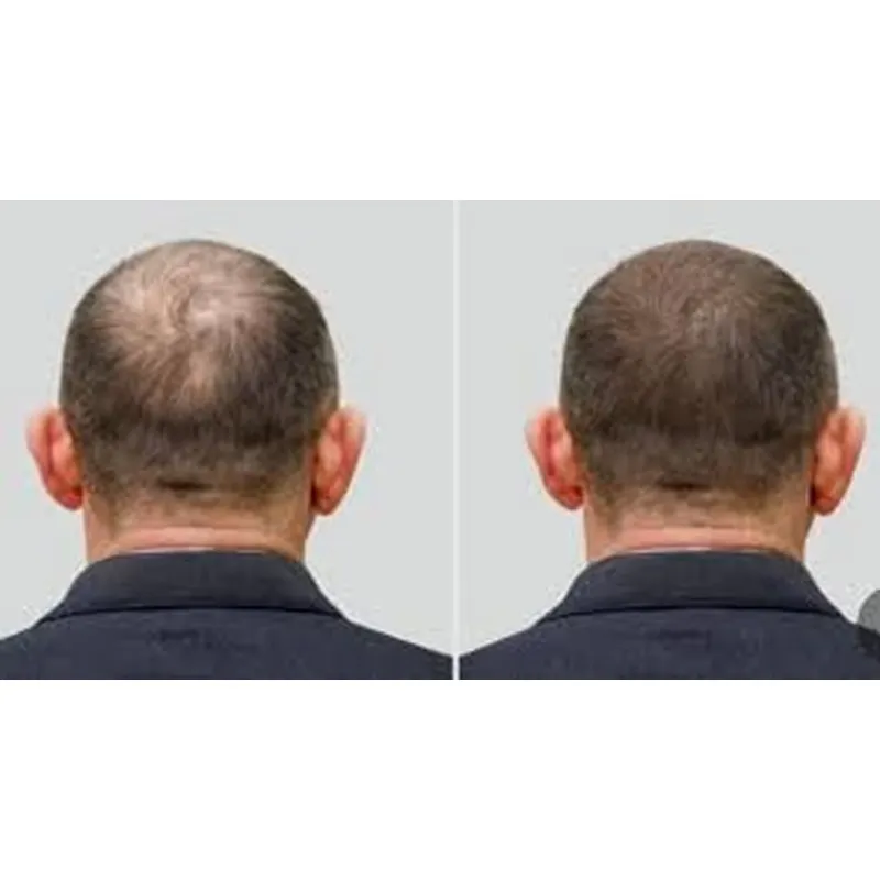 Cappello Ozono Good Seal per T - Hair Care Good Hair recensione e prezzo